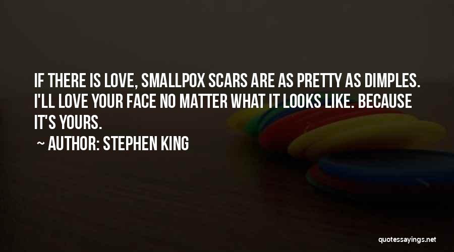 Stephen King Quotes: If There Is Love, Smallpox Scars Are As Pretty As Dimples. I'll Love Your Face No Matter What It Looks