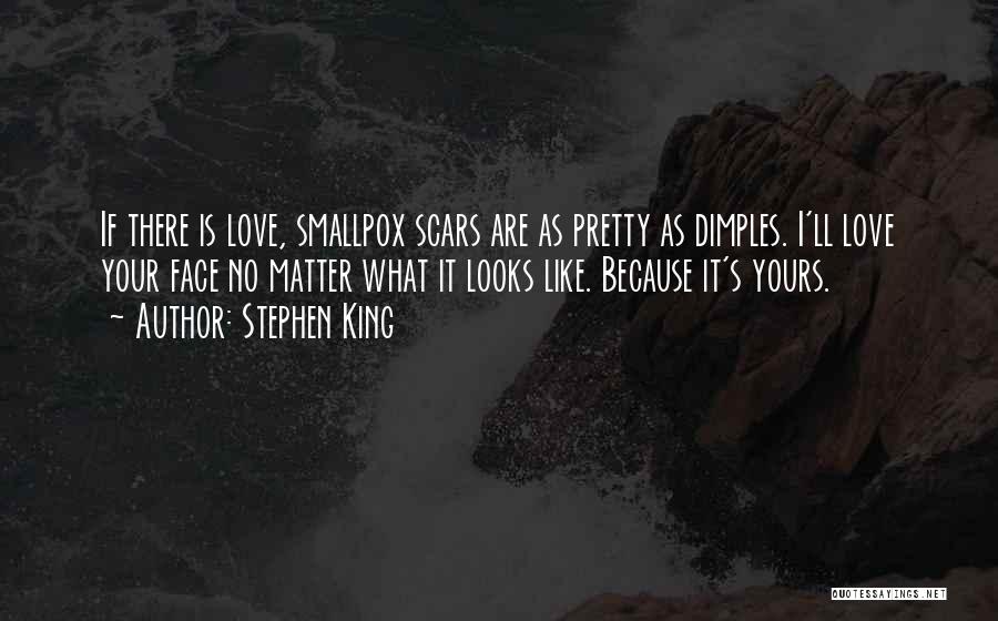 Stephen King Quotes: If There Is Love, Smallpox Scars Are As Pretty As Dimples. I'll Love Your Face No Matter What It Looks