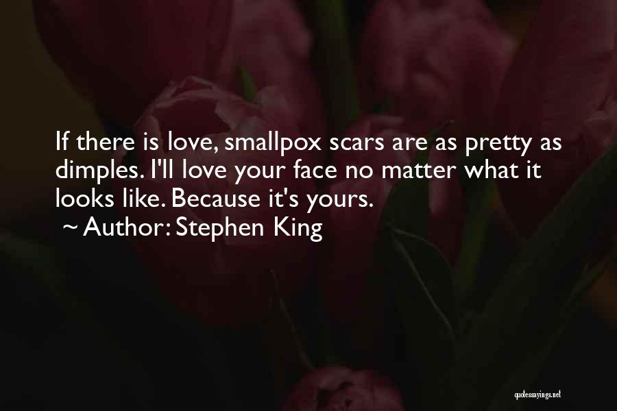 Stephen King Quotes: If There Is Love, Smallpox Scars Are As Pretty As Dimples. I'll Love Your Face No Matter What It Looks