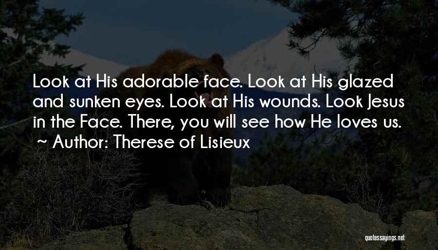 Therese Of Lisieux Quotes: Look At His Adorable Face. Look At His Glazed And Sunken Eyes. Look At His Wounds. Look Jesus In The