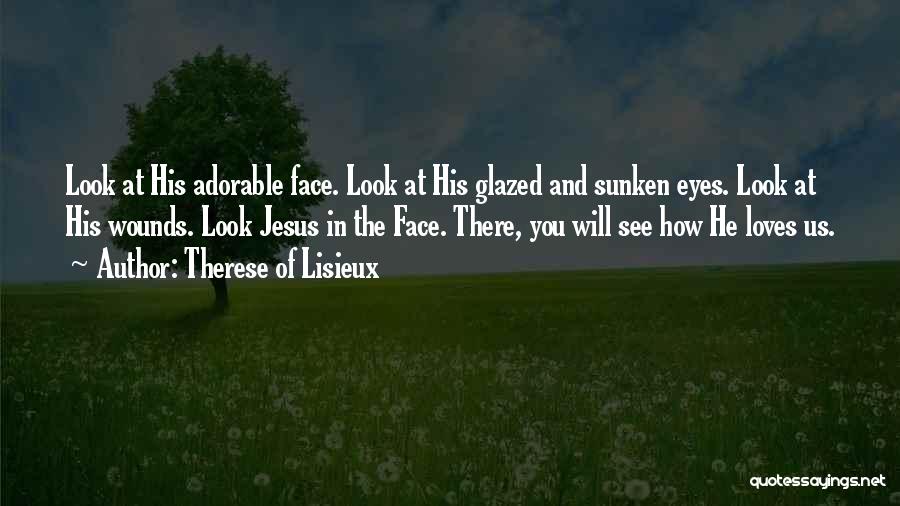 Therese Of Lisieux Quotes: Look At His Adorable Face. Look At His Glazed And Sunken Eyes. Look At His Wounds. Look Jesus In The