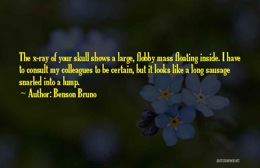 Benson Bruno Quotes: The X-ray Of Your Skull Shows A Large, Flobby Mass Floating Inside. I Have To Consult My Colleagues To Be