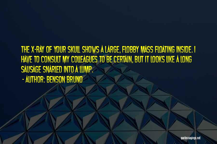 Benson Bruno Quotes: The X-ray Of Your Skull Shows A Large, Flobby Mass Floating Inside. I Have To Consult My Colleagues To Be