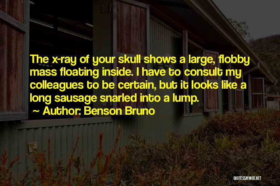 Benson Bruno Quotes: The X-ray Of Your Skull Shows A Large, Flobby Mass Floating Inside. I Have To Consult My Colleagues To Be
