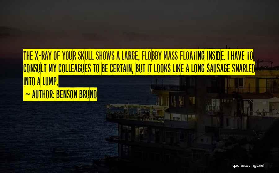Benson Bruno Quotes: The X-ray Of Your Skull Shows A Large, Flobby Mass Floating Inside. I Have To Consult My Colleagues To Be