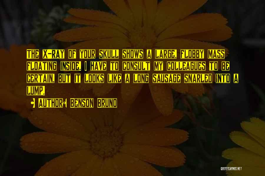 Benson Bruno Quotes: The X-ray Of Your Skull Shows A Large, Flobby Mass Floating Inside. I Have To Consult My Colleagues To Be