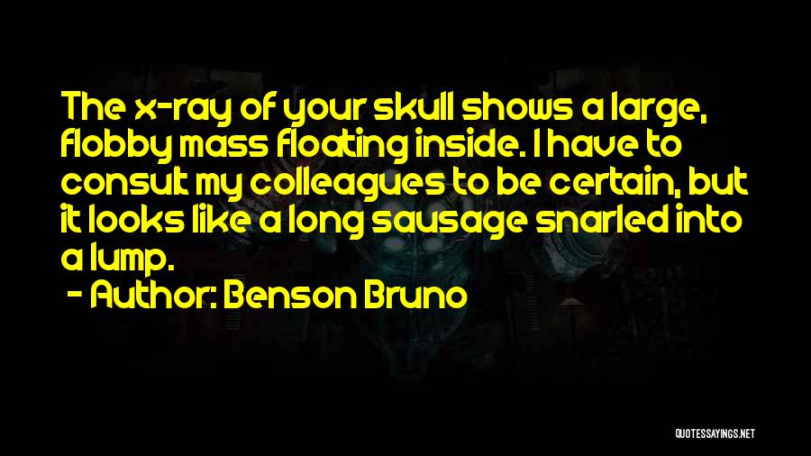 Benson Bruno Quotes: The X-ray Of Your Skull Shows A Large, Flobby Mass Floating Inside. I Have To Consult My Colleagues To Be