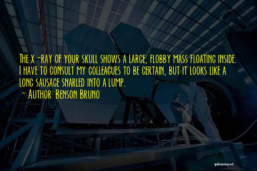 Benson Bruno Quotes: The X-ray Of Your Skull Shows A Large, Flobby Mass Floating Inside. I Have To Consult My Colleagues To Be