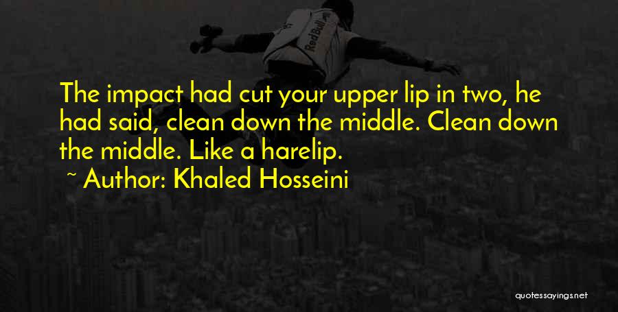 Khaled Hosseini Quotes: The Impact Had Cut Your Upper Lip In Two, He Had Said, Clean Down The Middle. Clean Down The Middle.