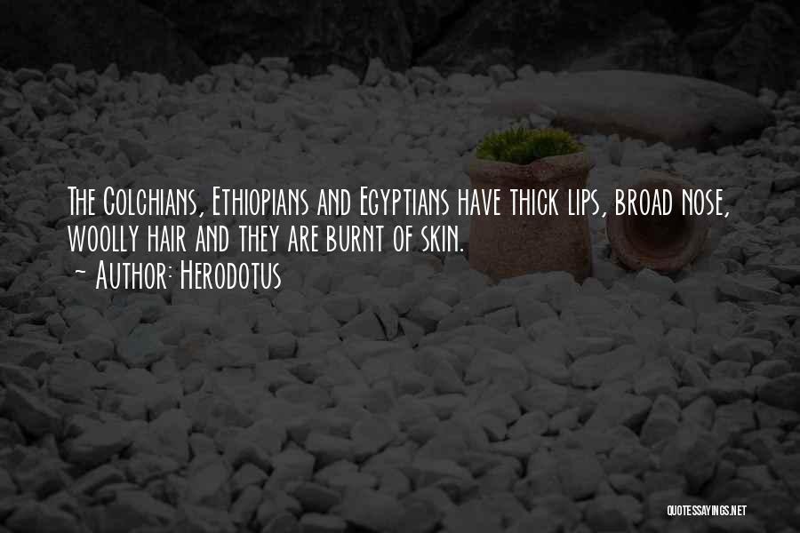 Herodotus Quotes: The Colchians, Ethiopians And Egyptians Have Thick Lips, Broad Nose, Woolly Hair And They Are Burnt Of Skin.
