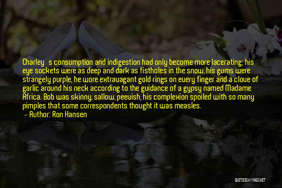 Ron Hansen Quotes: Charley's Consumption And Indigestion Had Only Become More Lacerating; His Eye Sockets Were As Deep And Dark As Fistholes In