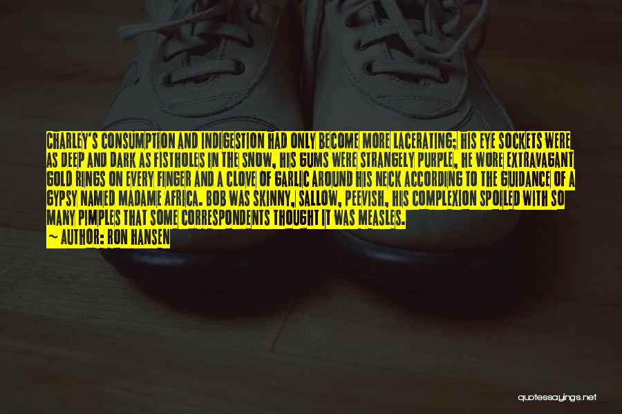 Ron Hansen Quotes: Charley's Consumption And Indigestion Had Only Become More Lacerating; His Eye Sockets Were As Deep And Dark As Fistholes In