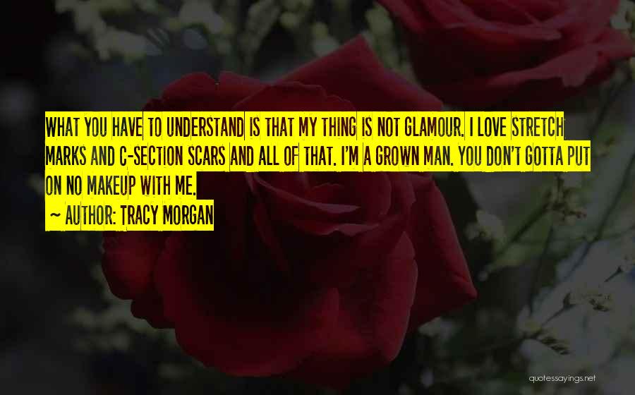 Tracy Morgan Quotes: What You Have To Understand Is That My Thing Is Not Glamour. I Love Stretch Marks And C-section Scars And