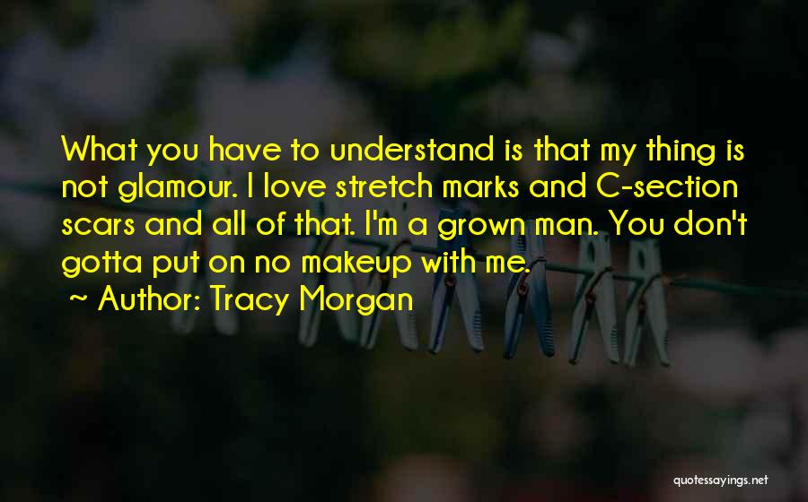 Tracy Morgan Quotes: What You Have To Understand Is That My Thing Is Not Glamour. I Love Stretch Marks And C-section Scars And