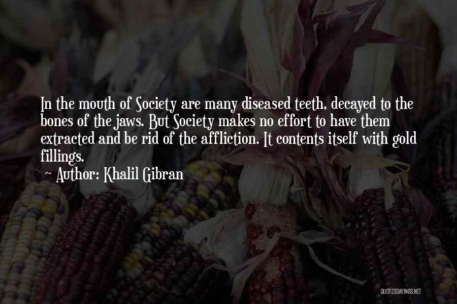 Khalil Gibran Quotes: In The Mouth Of Society Are Many Diseased Teeth, Decayed To The Bones Of The Jaws. But Society Makes No