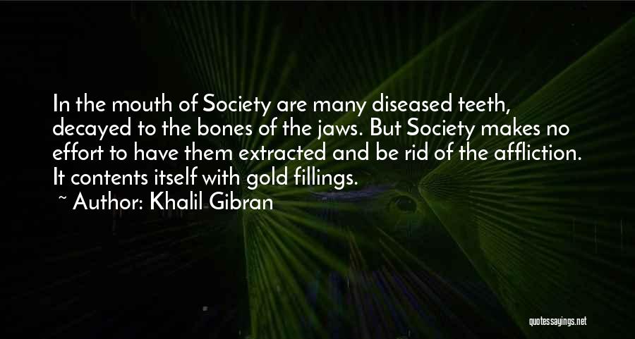 Khalil Gibran Quotes: In The Mouth Of Society Are Many Diseased Teeth, Decayed To The Bones Of The Jaws. But Society Makes No