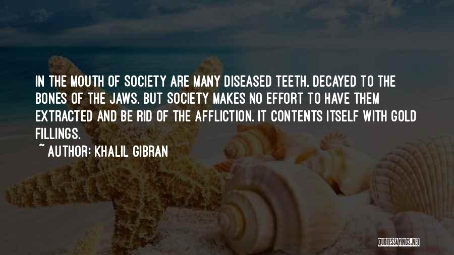 Khalil Gibran Quotes: In The Mouth Of Society Are Many Diseased Teeth, Decayed To The Bones Of The Jaws. But Society Makes No