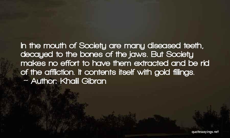 Khalil Gibran Quotes: In The Mouth Of Society Are Many Diseased Teeth, Decayed To The Bones Of The Jaws. But Society Makes No