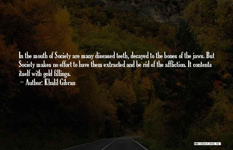 Khalil Gibran Quotes: In The Mouth Of Society Are Many Diseased Teeth, Decayed To The Bones Of The Jaws. But Society Makes No