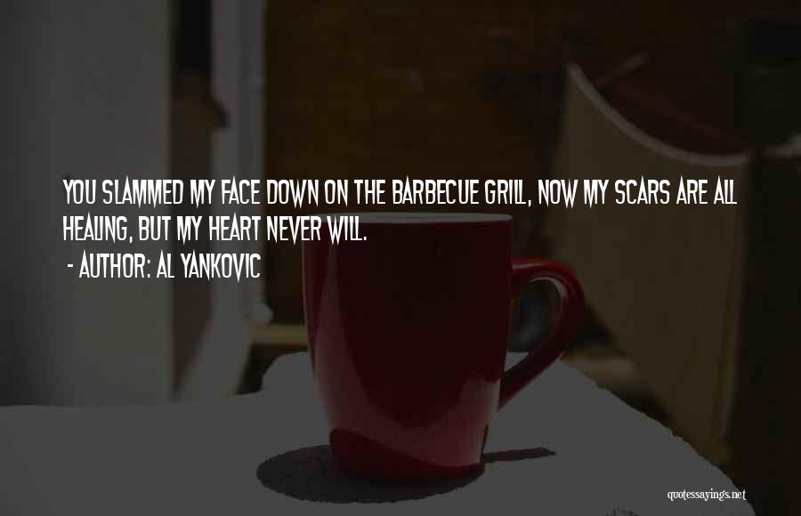Al Yankovic Quotes: You Slammed My Face Down On The Barbecue Grill, Now My Scars Are All Healing, But My Heart Never Will.
