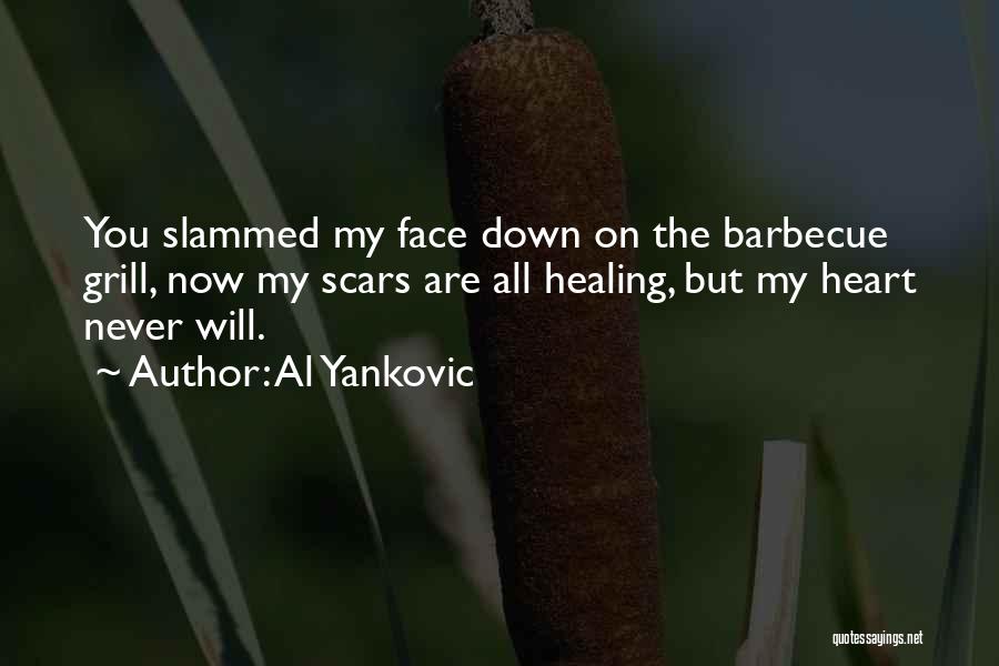 Al Yankovic Quotes: You Slammed My Face Down On The Barbecue Grill, Now My Scars Are All Healing, But My Heart Never Will.