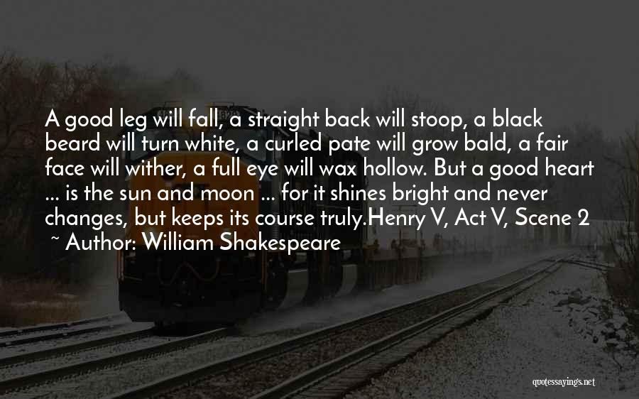 A Black Eye Quotes By William Shakespeare