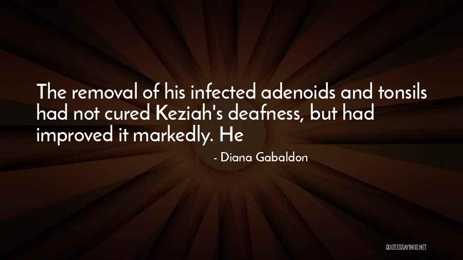 Adenoids And Tonsils Quotes By Diana Gabaldon