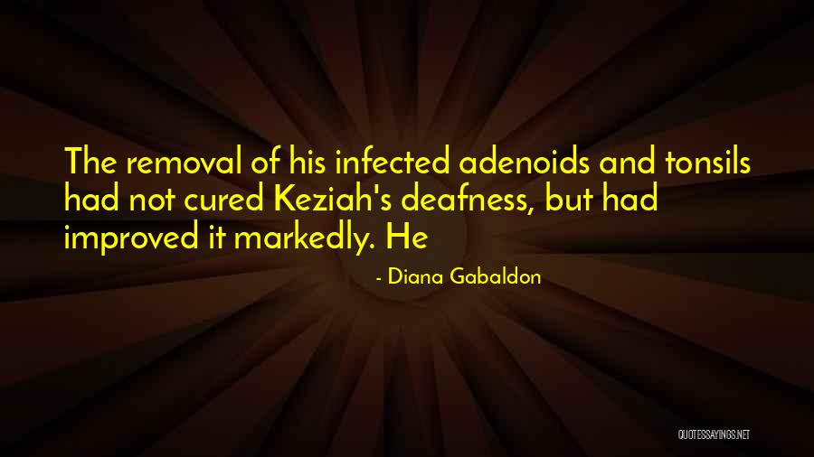 Adenoids Quotes By Diana Gabaldon Adenoids Quotes By Diana Gabaldon