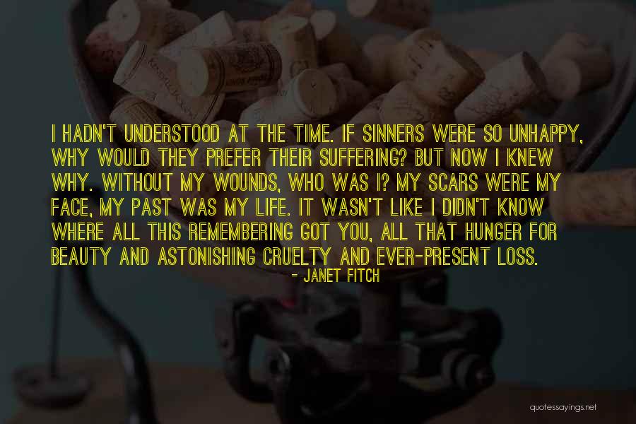 Beauty In Scars Quotes By Janet Fitch Beauty In Scars Quotes By Janet Fitch