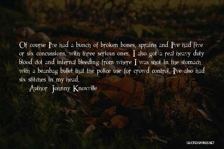 Bleeding Blood Quotes By Johnny Knoxville