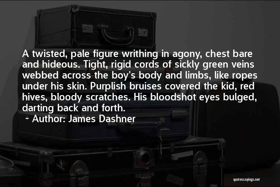 Bloodshot Eyes Quotes By James Dashner