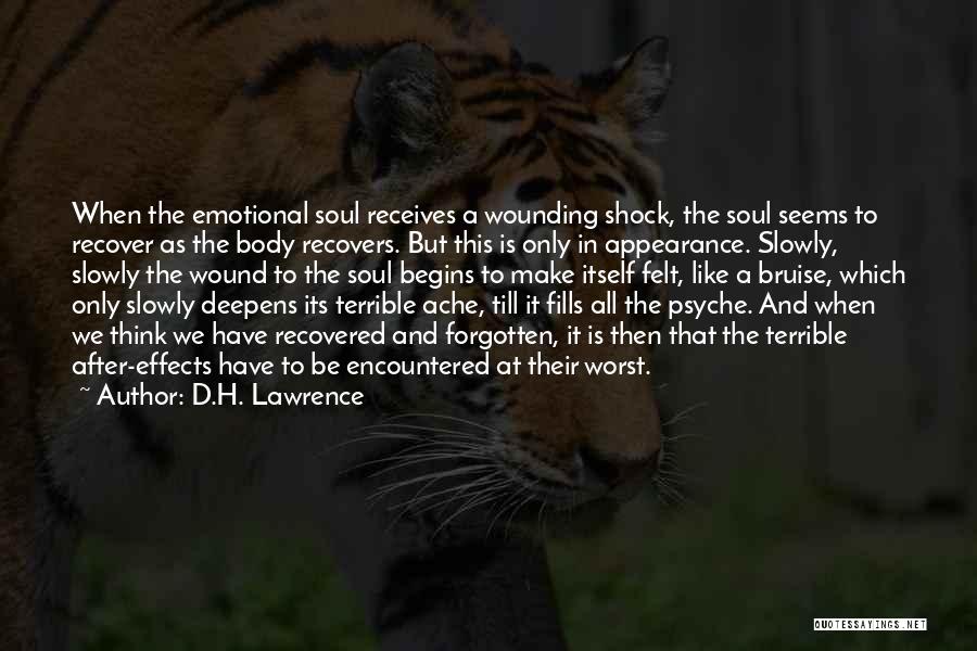 Body Ache Quotes By D.H. Lawrence