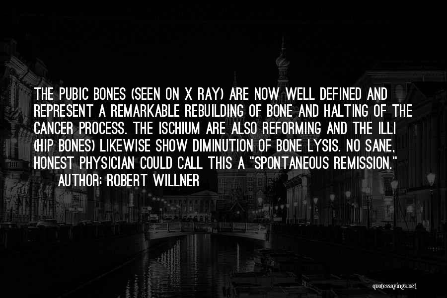 Bone Cancer Quotes By Robert Willner