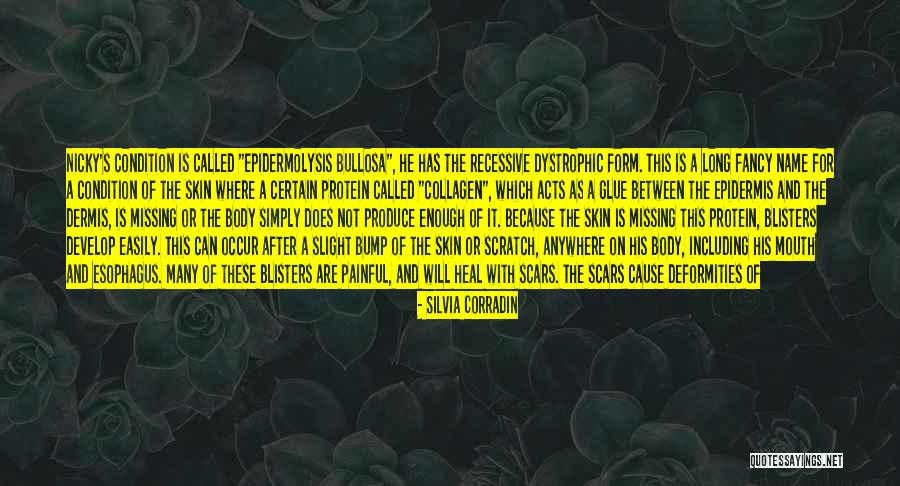 Bullosa Quotes By Silvia Corradin Bullosa Quotes By Silvia Corradin