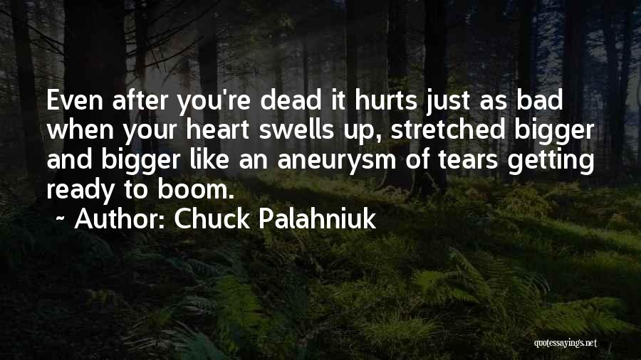 Even It Hurts Quotes By Chuck Palahniuk