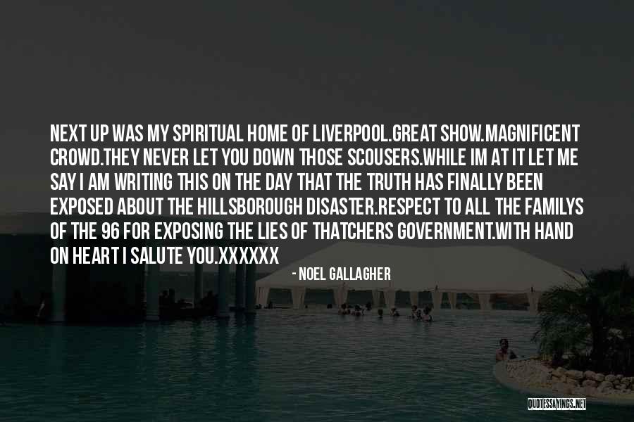 Exposed Heart Quotes By Noel Gallagher