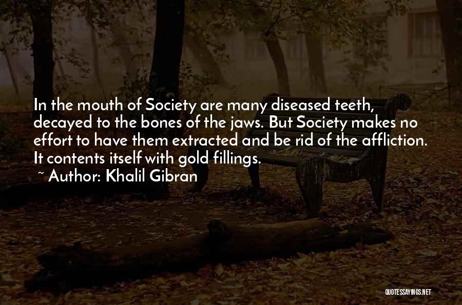 Gold Teeth Quotes By Khalil Gibran