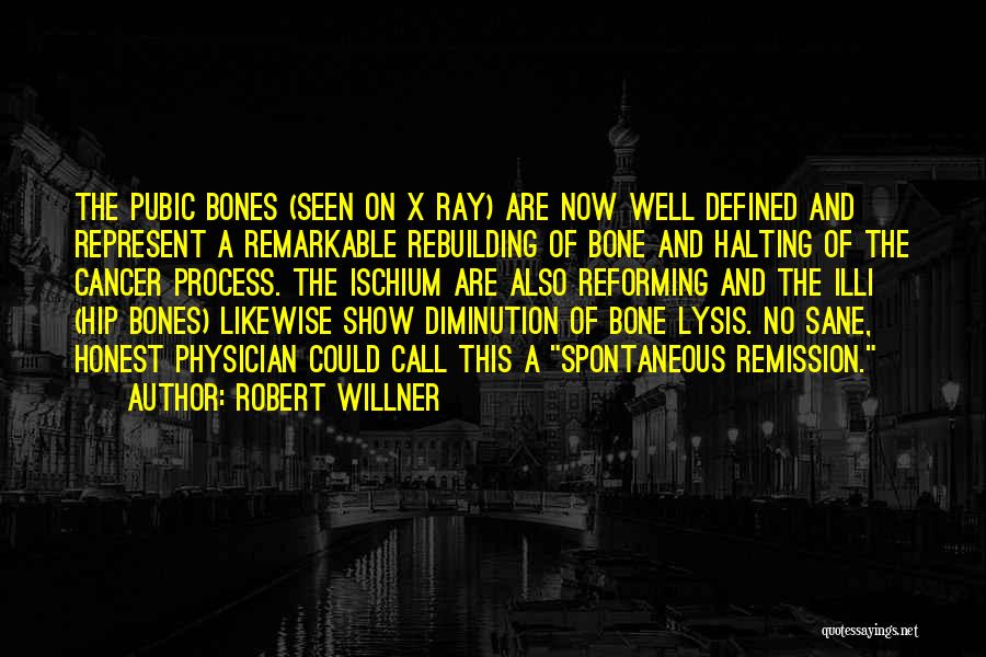 Hip Bones Quotes By Robert Willner