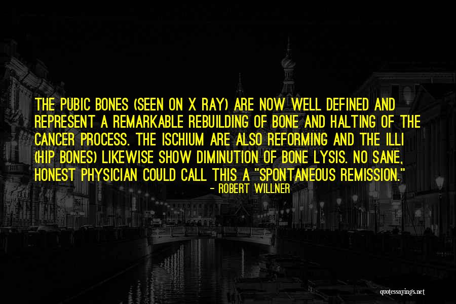 Ischium Quotes By Robert Willner Ischium Quotes By Robert Willner