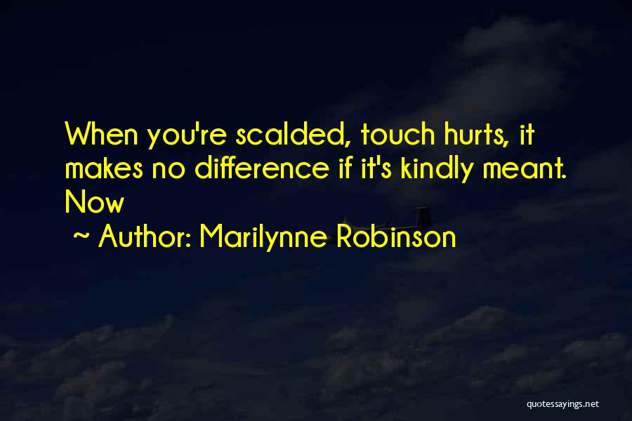 It Hurts Now Quotes By Marilynne Robinson
