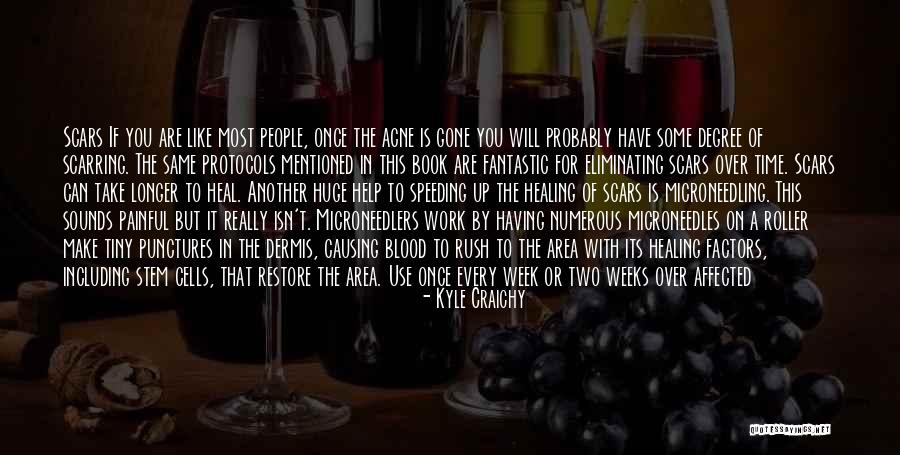 Izolovana Quotes By Kyle Craichy Izolovana Quotes By Kyle Craichy