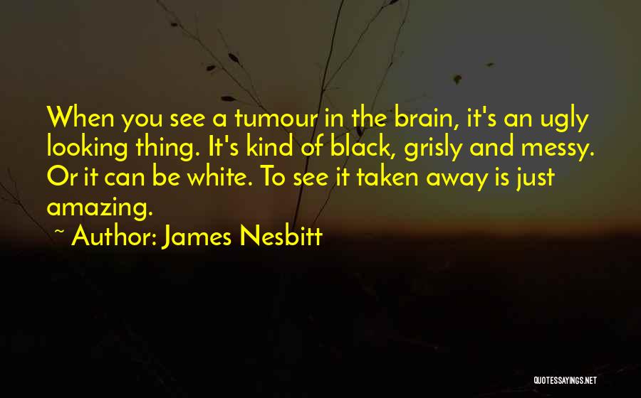 James Nesbitt Quotes 338405