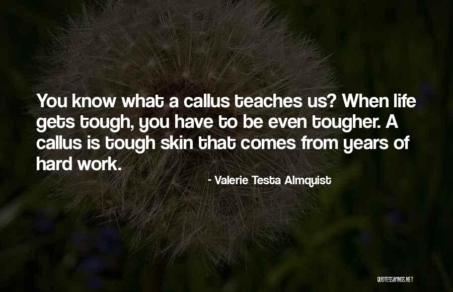 Life Callus Quotes By Valerie Testa Almquist Life Callus Quotes By Valerie Testa Almquist