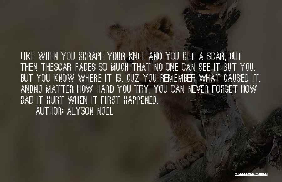 Never Forget Who Hurt You Quotes By Alyson Noel