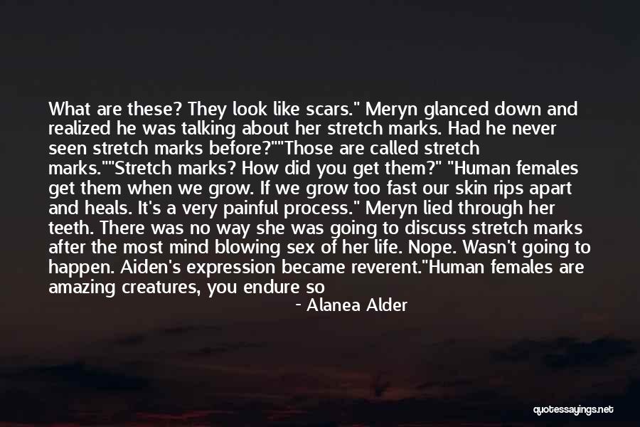 Pain Heals Quotes By Alanea Alder