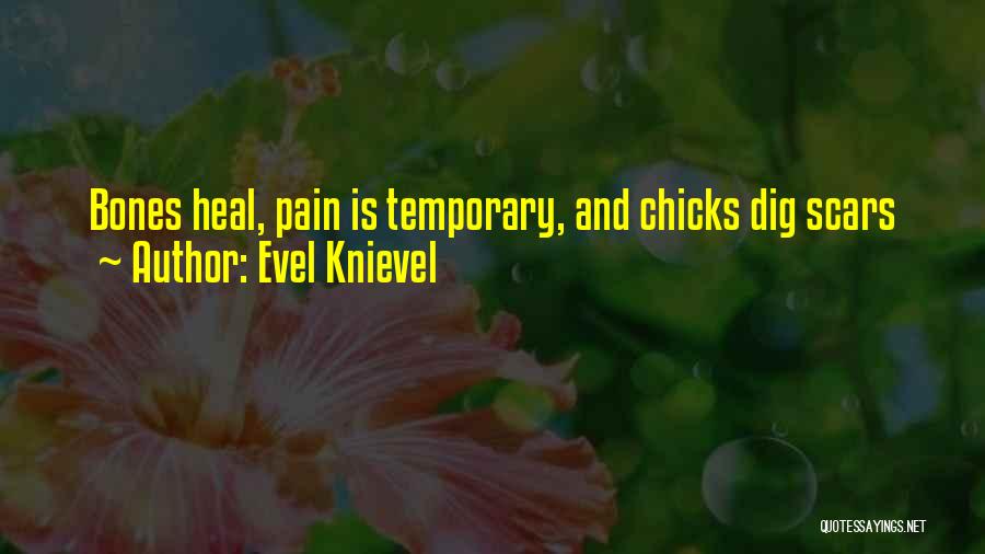 Pain Is Temporary Quotes By Evel Knievel