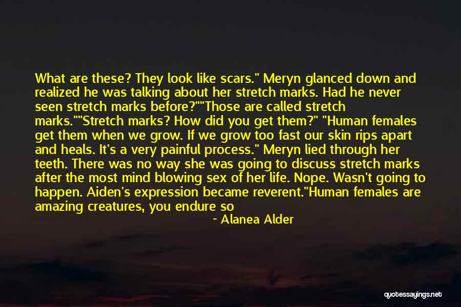 Pain That Never Heals Quotes By Alanea Alder Pain That Never Heals Quotes By Alanea Alder