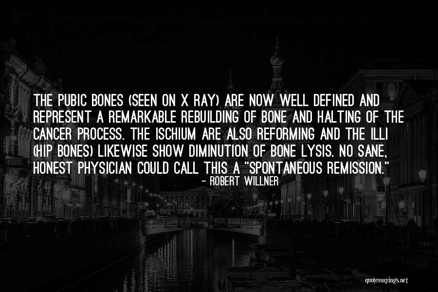 Remission Of Cancer Quotes By Robert Willner