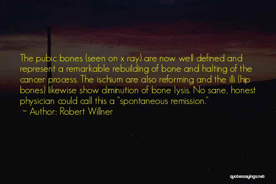 Robert Willner Quotes 1154869