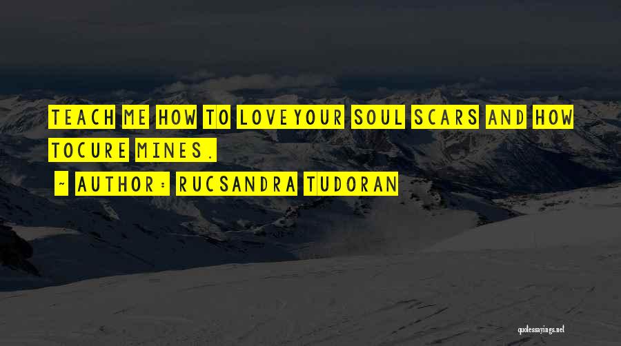 Scars Love Quotes By Rucsandra Tudoran